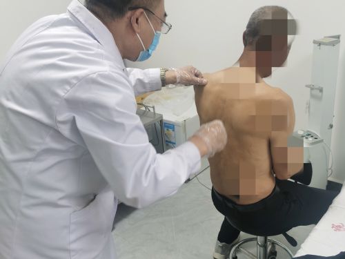 图为项部发际多发性毛囊炎经络环皮部挑治疗法