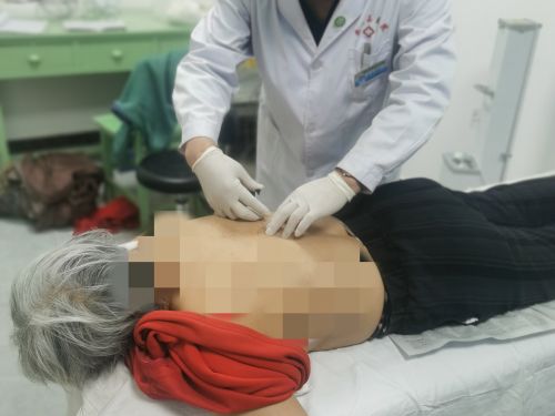 图为带状疱疹埋线治疗